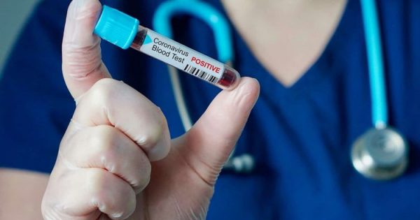 Azərbaycanda daha dörd nəfərdə koronavirus aşkarlanıb