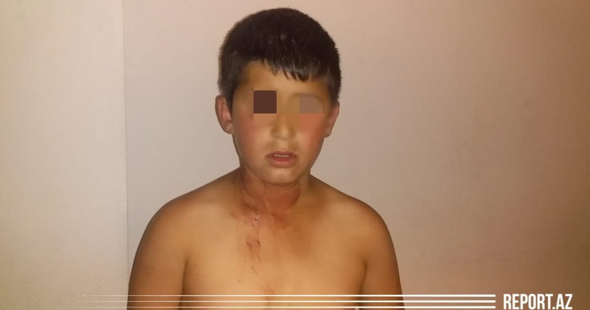 Bakıda dəhşət – Ata dilənmək istəməyən 11 yaşlı oğlunu başından bıçaqladı – FOTO