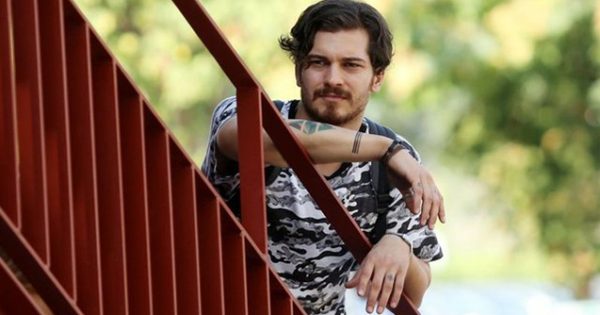 Türkiyəli məşhurun görünüşünü dəyişdirmə səbəbi məlum oldu- Foto