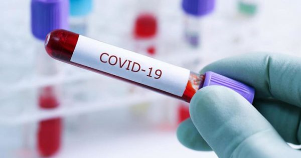 Azərbaycanda son sutkada 32 nəfər koronavirusdan vəfat edib