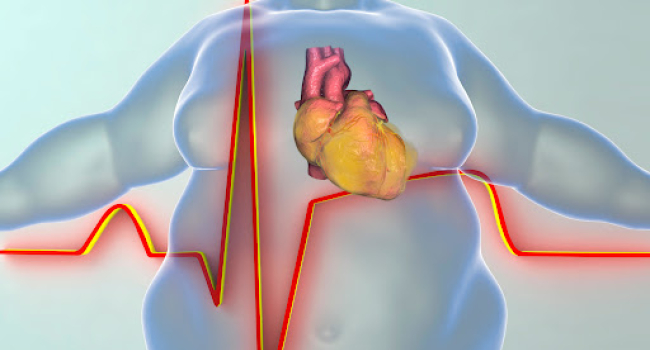 Piylənmənin ürək üçün daha bir təhlükəsi müəyyən edilib 1 image-40018